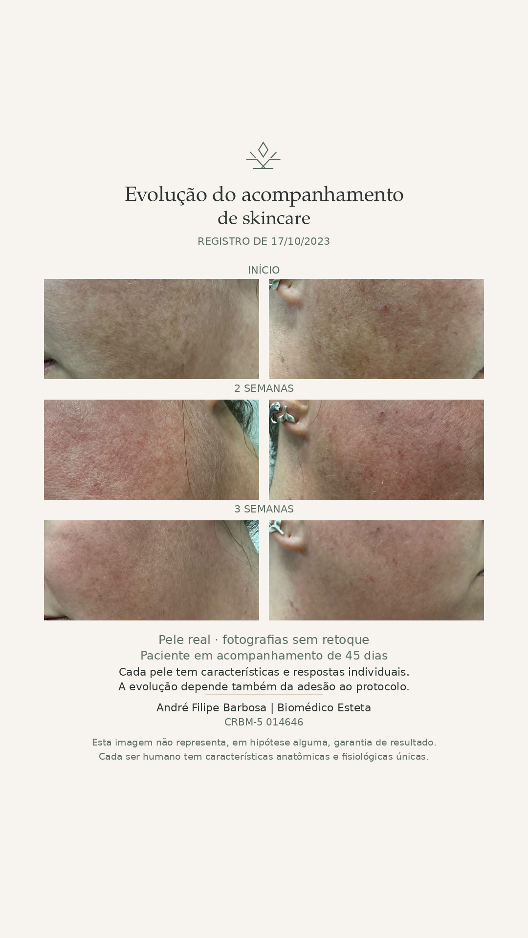 Evolução do acompanhamento de skincare: fotografias clínicas da paciente no início, após duas semanas e após três semanas, com identificação SRFIL e registro profissional até o CRBM.
